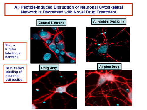 Aβ Peptide-induced Disruption of Neuronal Cytoskeletal Network is Decreased with Novel Drug Treatment